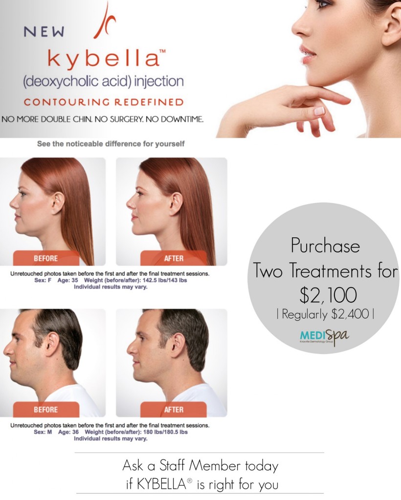 kybella-in-pic-form